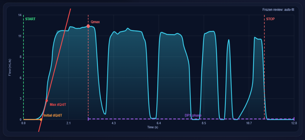 Vectrys curve screen